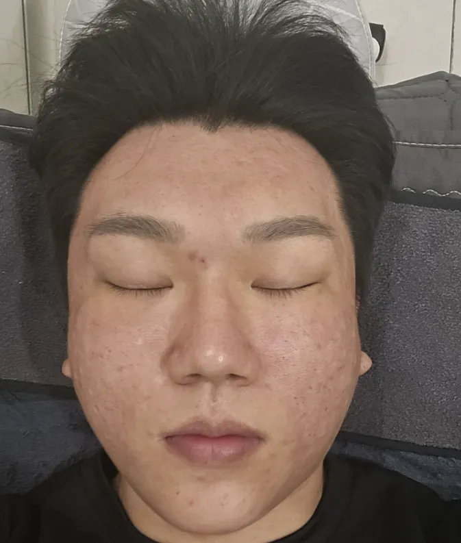 ehdlfdl.png.webp