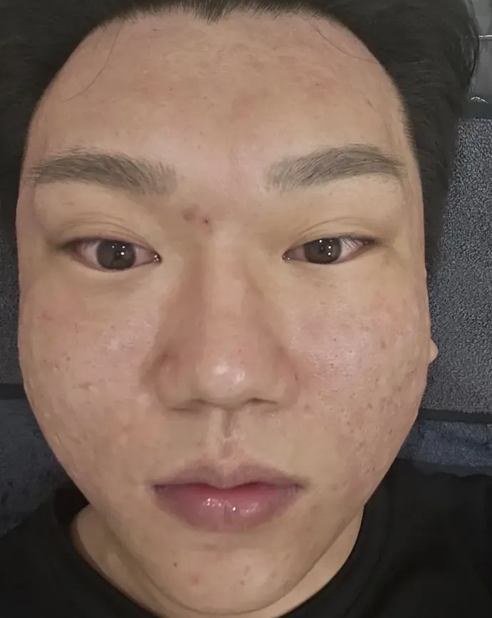 ehdlfdl2.png.webp